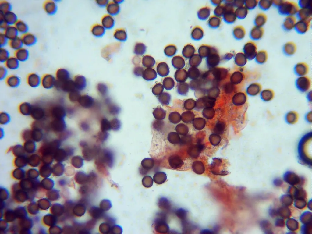 Microscopía de Physarum compressum - 14 - ampliación Capilicio